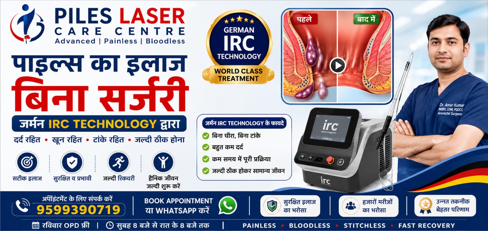 Piles (Hemorrhoids) laser treatment information